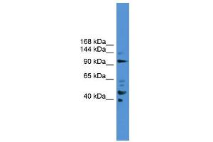 WB Suggested Anti-PIBF1 Antibody Titration: 0. (PIBF1 anticorps  (C-Term))