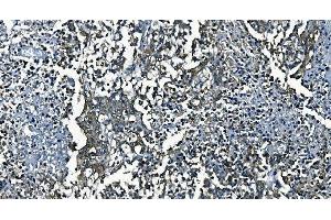 IHC analysis of PCBP2/hnRNP E2 using anti-PCBP2/hnRNP E2 antibody (ABIN7600449). (PCBP2 anticorps  (AA 197-276))