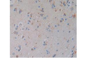 Detection of HO1 in Human Brain Tissue using Monoclonal Antibody to Heme Oxygenase 1 (HO1) (HMOX1 anticorps  (AA 61-172))