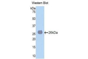 Western Blotting (WB) image for anti-Laminin, alpha 4 (LAMa4) (AA 745-940) antibody (ABIN1859600) (LAMa4 anticorps  (AA 745-940))
