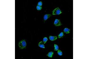 IF analysis of KLHL12 using anti-KLHL12 antibody (ABIN7601009).
