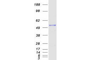 Validation with Western Blot