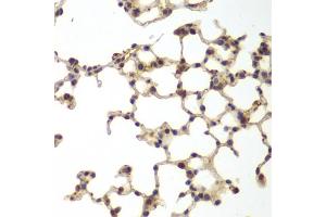 Immunohistochemistry of paraffin-embedded mouse lung using GSS antibody (ABIN6290429) at dilution of 1:200 (40x lens).