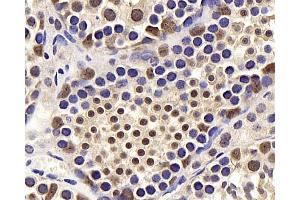 Immunohistochemistry analysis of paraffin-embedded mouse testis using BRAF Polyclonal Antibody at dilution of 1:400. (BRAF anticorps)