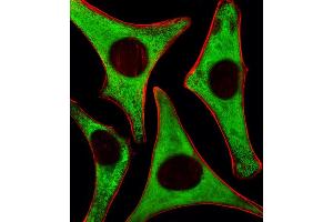 Fluorescent image of Hela cells stained with RPS6 Antibody (N-term) .