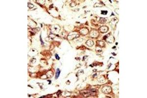 Image no. 2 for anti-Insulin Receptor-Related Receptor (INSRR) (C-Term) antibody (ABIN359889) (INSRR anticorps  (C-Term))