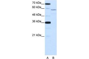 Western Blotting (WB) image for anti-Neuro-Oncological Ventral Antigen 2 (NOVA2) antibody (ABIN2462125) (NOVA2 anticorps)