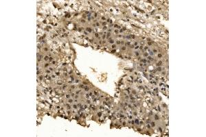 IHC analysis of CPSF6 using anti-CPSF6 antibody (ABIN7601898).