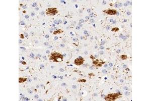 Immunohistochemistry analysis of paraffin-embedded rat brain using,PGS1 (ABIN7075039) at dilution of 1: 600 (PGS1 anticorps)