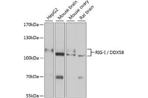 Western blot analysis of extracts of various cell lines, using Rig-I/DDX58 antibody (ABIN6130263, ABIN6139513, ABIN6139515 and ABIN6217394) at 1:1000 dilution. (DDX58 anticorps  (AA 726-925))