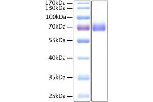 Recombinant 2019-nCoV Spike S2 ECD Protein with His tag was determined by SDS-PAGE with Coomassie Blue, showing a band at 70 kDa.