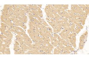 Detection of SLN in Human Cardiac Muscle Tissue using Polyclonal Antibody to Sarcolipin (SLN) (SLN anticorps  (AA 1-31))