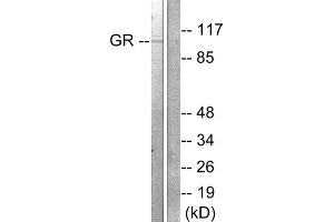 Western blot analysis of extracts from HeLa cells treated with PMA (125ng/ml, 30min), using GR (epitope around residue 211) antibody (ABIN5976159, Line 1 and 2). (GR (Internal Region), (pSer211) anticorps)