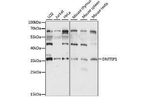 Western blot analysis of extracts of various cell lines, using DNTTIP1 antibody (ABIN6290313) at 1:1000 dilution.