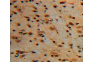 IHC-P analysis of brain tissue, with DAB staining. (PKC gamma anticorps  (AA 351-614))
