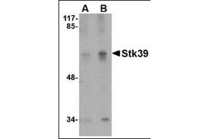Western blot analysis of Stk39 in SK-N-SH cell lysate with this product at (A) 1 and (B) 2 μg/ml. (STK39 anticorps  (C-Term))