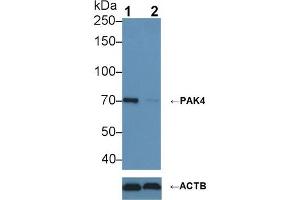 Knockout Varification: ;Lane 1: Wild-type Hela cell lysate; ;Lane 2: PAK4 knockout Hela cell lysate; ;Predicted MW: 64kDa ;Observed MW: 70kDa;Primary Ab: 1µg/ml Rabbit Anti-Human PAK4 Antibody;Second Ab: 0.