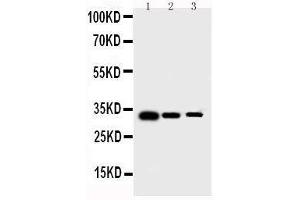 Anti-human Survivin antibody, Western blotting Lane 1: Recombinant Human Survivin Protein 10ng Lane 2: Recombinant Human Survivin Protein 5ng Lane 3: Recombinant Human Survivin Protein 2 (Survivin anticorps  (AA 1-142))