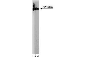Western blot analysis of BRUCE on a SW-13 cell lysate (Human adrenal gland carcinoma, ATCC CCL-105). (BIRC6 anticorps  (AA 372-571))