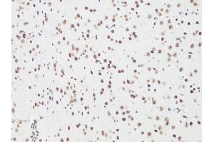 Immunohistochemistry of paraffin-embedded Rat brain using Bcl9 antibody (ABIN6129972, ABIN6137514, ABIN6137515 and ABIN6222543) at dilution of 1:100 (20x lens). (BCL9 anticorps)