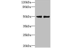 Western blot All lanes: FAM118B antibody at 12 μg/mL Lane 1: Jurkat whole cell lysate Lane 2: U251 whole cell lysate Secondary Goat polyclonal to rabbit IgG at 1/10000 dilution Predicted band size: 39 kDa Observed band size: 39 kDa (FAM118B anticorps  (AA 83-351))