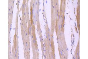 Immunohistochemistry of paraffin-embedded mouse heart using ROCK1 antibody (ABIN5997107) at dilution of 1/100 (40x lens). (ROCK1 anticorps)
