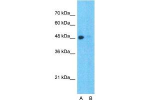 Host:  Rabbit  Target Name:  SPOP  Sample Type:  Hela  Lane A:  Primary Antibody  Lane B:  Primary Antibody + Blocking Peptide  Primary Antibody Concentration:  1ug/ml  Peptide Concentration:  5ug/ml  Lysate Quantity:  25ug/lane/lane  Gel Concentration:  0. (SPOP-B anticorps  (C-Term))