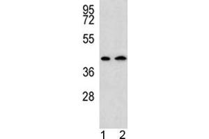 AADAT antibody western blot analysis in human 1) HepG2, and 2) Y79 lysate. (AADAT anticorps  (AA 196-224))