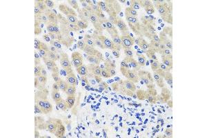 Immunohistochemistry of paraffin-embedded human liver injury using HSD11B2 antibody (ABIN5995471) at dilution of 1/100 (40x lens). (HSD11B2 anticorps)