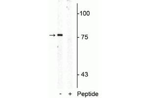Western blot of rat mid brain membrane lysate showing specific immunolabeling of the ~76 kDa SERT protein phosphorylated at Thr276 in the first lane (-).