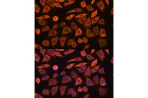 Immunofluorescence analysis of L929 cells using GUCY1 Rabbit pAb (ABIN6127969, ABIN6141533, ABIN6141534 and ABIN6216446) at dilution of 1:100 (40x lens).