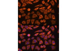 Immunofluorescence analysis of L929 cells using GUCY1 Rabbit pAb (ABIN6127969, ABIN6141533, ABIN6141534 and ABIN6216446) at dilution of 1:100 (40x lens). (GUCY1A1 anticorps  (AA 1-120))