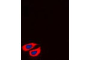 Immunofluorescent analysis of Collagen 6 alpha 2 staining in HT29 cells.