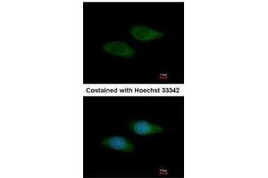 ICC/IF Image Immunofluorescence analysis of methanol-fixed HeLa, using SNTB2, antibody at 1:200 dilution. (SNTB2 anticorps)