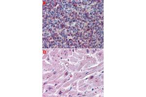 Immunohistochemistry (Formalin/PFA-fixed paraffin-embedded sections) of human spleen (A) and human heart tissue (B) with CYSLTR2 polyclonal antibody . (CasLTR2 anticorps  (Extracellular Domain))