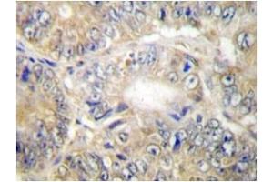 Image no. 1 for anti-Tumor Necrosis Factor (Ligand) Superfamily, Member 13 (TNFSF13) antibody (ABIN272145) (TNFSF13 anticorps)