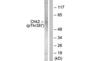Western blot analysis of extracts from Jurkat cells, using Chk2 (Phospho-Thr387) Antibody. (CHEK2 anticorps  (pThr387))