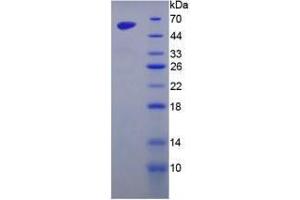 Image no. 1 for Golgi Membrane Protein 1 (GOLM1) (AA 133-379) (Active) protein (His tag,GST tag) (ABIN6239881)