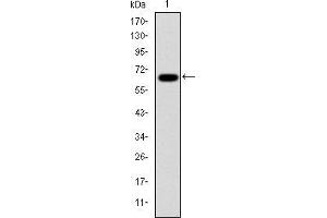Western blot analysis using PSMB8 mAb against human PSMB8 (AA: 1-272) recombinant protein.