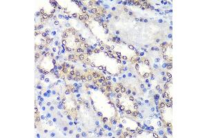 Immunohistochemistry of paraffin-embedded Rat kidney using PSME4 Rabbit pAb  at dilution of 1:100 (40x lens).