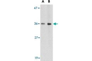 Western blot analysis of HAPLN2 in human brain tissue lysate with HAPLN2 polyclonal antibody  at (A) 1 and (B) 2 ug/mL . (HAPLN2 anticorps  (Internal Region))