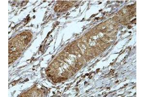 Immunohistochemistry (IHC) image for anti-Phosphatidic Acid Phosphatase Type 2 Domain Containing 1A (PPAPDC1A) (AA 89-149) antibody (ABIN1856403) (PPAPDC1A anticorps  (AA 89-149))