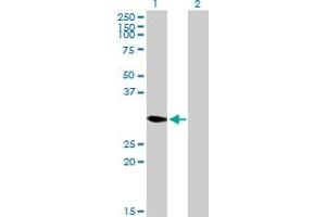 DECR2 anticorps  (AA 1-292)