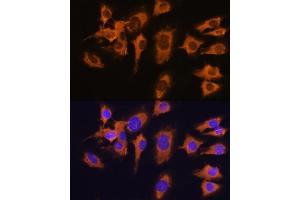 Immunofluorescence analysis of C6 cells using SLC20 antibody (ABIN1682754, ABIN3018562, ABIN3018563 and ABIN6220499) at dilution of 1:100. (SLC20A1 anticorps  (AA 257-356))