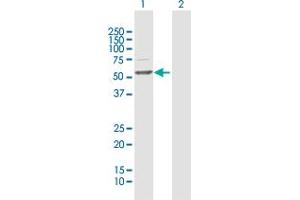 Western Blot analysis of TBL1X expression in transfected 293T cell line by TBL1X MaxPab polyclonal antibody. (TBL1X anticorps  (AA 1-526))