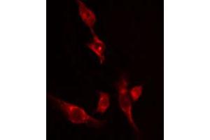 ABIN6274526 staining 293 cells by IF/ICC. (Ethanolamine Kinase 2 anticorps  (Internal Region))