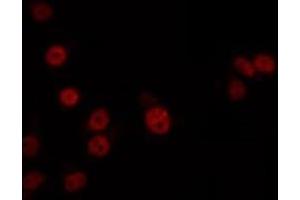 ABIN6266724 staining 293 by IF/ICC.