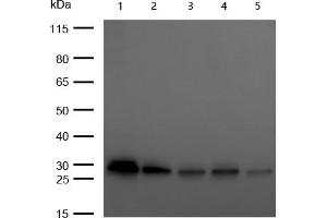 All lanes : C1QBP Rabbit mAb at 1/1k dilution Lane 1 : 293T whole cell lysates Lane 2 : A549 whole cell lysates Lane 3 : Hela whole cell lysates Lane 4 : HepG2 whole cell lysates Lane 5 : C2C12 whole cell lysates Lysates/proteins at 20 μg per lane.