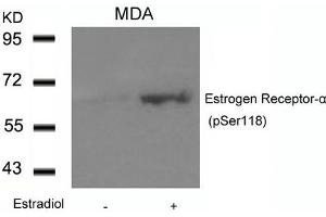 Western blot analysis of extracts from MDA cells untreated or treated with Estradiol using Estrogen Receptor-a(Phospho-Ser118) Antibody. (Estrogen Receptor alpha anticorps  (pSer118))