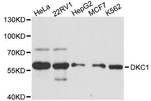 Western blot analysis of extracts of various cell lines, using DKC1 antibody. (DKC1 anticorps  (AA 1-180))